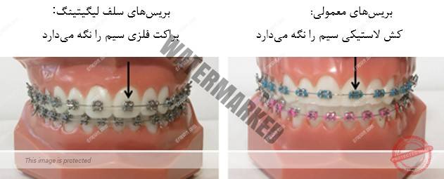 باورها و شایعات درمان ارتودنسی