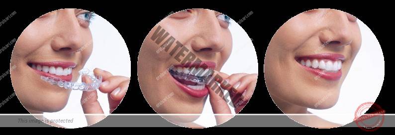 باورها و شایعات درمان ارتودنسی