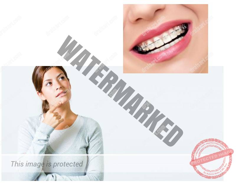 نکاتی که باید قبل از آغاز درمان ارتودنسی بدانید