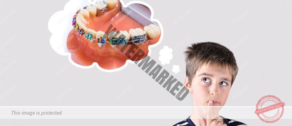 اشتباهات بزرگ درباره درمان ارتودنسی